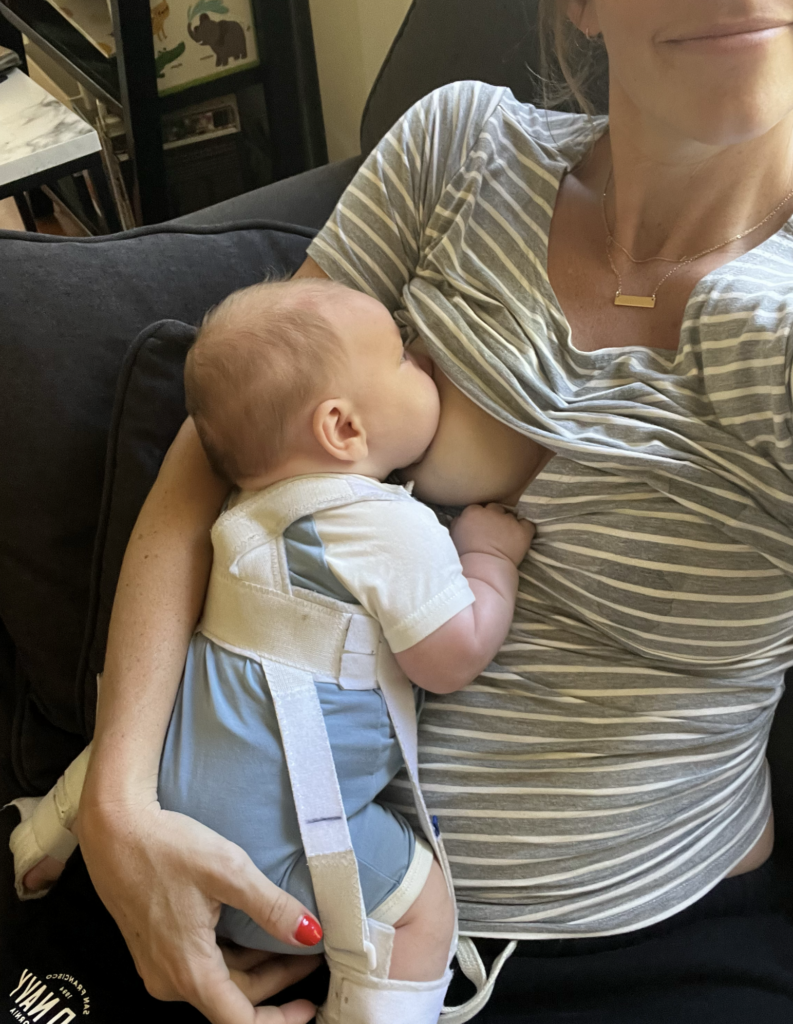 hip dysplasia breastfeeding